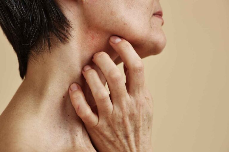 Eczema – symptoms, causes, and ways to cope