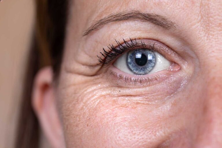 5 eye problems linked with menopause