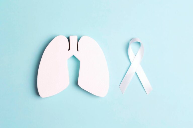 Lung cancer – symptoms, causes, and treatment